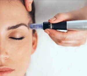Tratamiento Dermapen en ASAMI Estética Tarragona para rejuvenecimiento facial